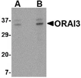 Anti-ORAI3 antibody used in Western Blot (WB). GTX85677