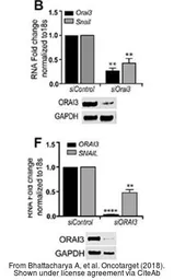 Anti-ORAI3 antibody used in Western Blot (WB). GTX85677