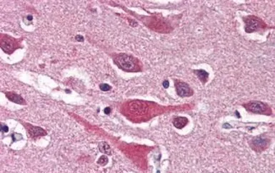 Anti-LAP1 antibody used in IHC (Paraffin sections) (IHC-P). GTX85708