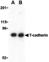 Anti-CDH13 antibody used in Western Blot (WB). GTX85891