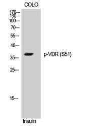 Anti-Vitamin D Receptor (phospho Ser51) antibody used in Western Blot (WB). GTX86040