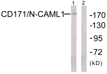 Anti-L1CAM antibody used in Western Blot (WB). GTX87010