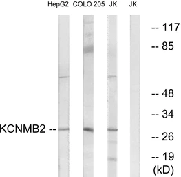 Anti-KCNMB2 antibody used in Western Blot (WB). GTX87038