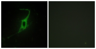 Anti-CDH20 antibody used in Immunocytochemistry/ Immunofluorescence (ICC/IF). GTX87050