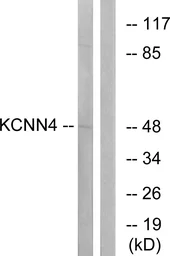 Anti-KCNN4 antibody used in Western Blot (WB). GTX87069