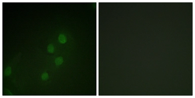 Anti-MYF5 antibody used in Immunocytochemistry/ Immunofluorescence (ICC/IF). GTX87110