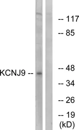 Anti-KCNJ9 antibody used in Western Blot (WB). GTX87115