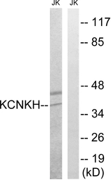 Anti-KCNK17 antibody used in Western Blot (WB). GTX87141