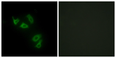 Anti-MUC13 antibody used in Immunocytochemistry/ Immunofluorescence (ICC/IF). GTX87168