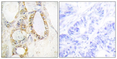 Anti-MUC13 antibody used in IHC (Paraffin sections) (IHC-P). GTX87168