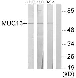 Anti-MUC13 antibody used in Western Blot (WB). GTX87168