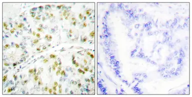 Anti-Ataxin 1 antibody used in IHC (Paraffin sections) (IHC-P). GTX87190