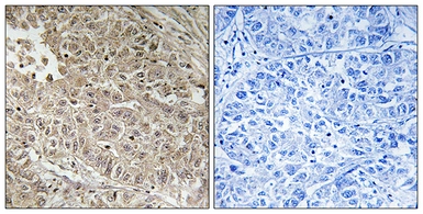 Anti-ABCC13 antibody used in IHC (Paraffin sections) (IHC-P). GTX87241