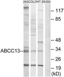 Anti-ABCC13 antibody used in Western Blot (WB). GTX87241