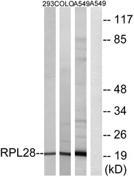 Anti-RPL28 antibody used in Western Blot (WB). GTX87242