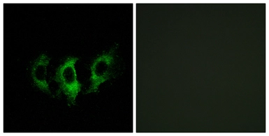 Anti-GFM2 antibody used in Immunocytochemistry/ Immunofluorescence (ICC/IF). GTX87245