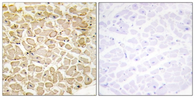 Anti-CDH13 antibody used in IHC (Paraffin sections) (IHC-P). GTX87281