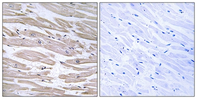 Anti-DNAJB11 antibody used in IHC (Paraffin sections) (IHC-P). GTX87306