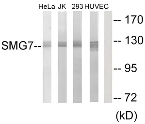 Anti-SMG7 antibody used in Western Blot (WB). GTX87360