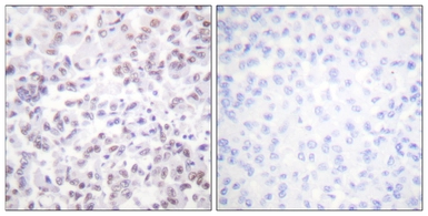 Anti-Histone H2B antibody used in IHC (Paraffin sections) (IHC-P). GTX87385