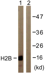 Anti-Histone H2B antibody used in Western Blot (WB). GTX87385