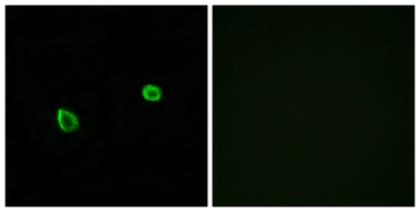 Anti-IRE1 beta antibody used in Immunocytochemistry/ Immunofluorescence (ICC/IF). GTX87426