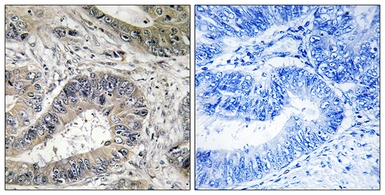 Anti-IRE1 beta antibody used in IHC (Paraffin sections) (IHC-P). GTX87426