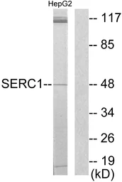Anti-SERINC1 antibody used in Western Blot (WB). GTX87464