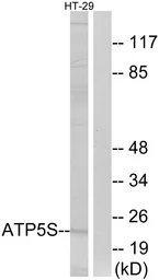 Anti-ATP5S antibody used in Western Blot (WB). GTX87485