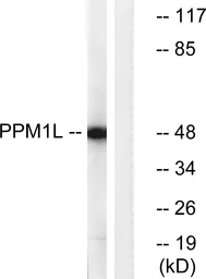 Anti-PPM1L antibody used in Western Blot (WB). GTX87651