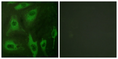 Anti-Aquaporin 2 antibody used in Immunocytochemistry/ Immunofluorescence (ICC/IF). GTX87696