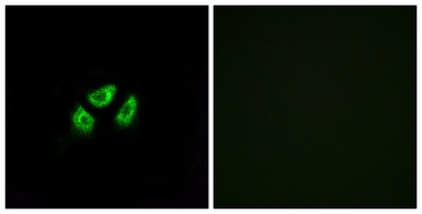 Anti-SCN7A antibody used in Immunocytochemistry/ Immunofluorescence (ICC/IF). GTX87701