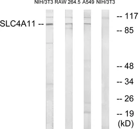 Anti-SLC4A11 antibody used in Western Blot (WB). GTX87741