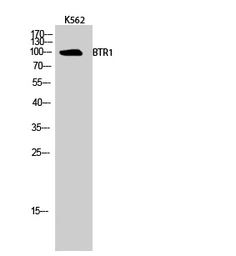 Anti-SLC4A11 antibody used in Western Blot (WB). GTX87741