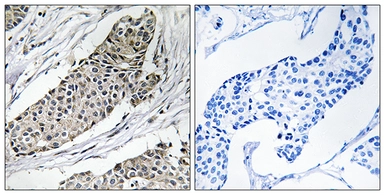 Anti-KCNAB3 antibody used in IHC (Paraffin sections) (IHC-P). GTX87771