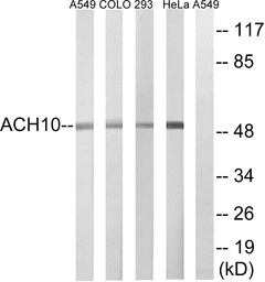 Anti-AChR alpha 10 antibody used in Western Blot (WB). GTX87783