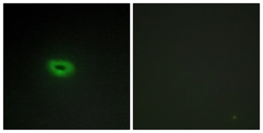 Anti-ECRG4 antibody used in Immunocytochemistry/ Immunofluorescence (ICC/IF). GTX87799