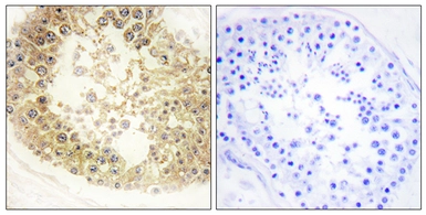 Anti-ECRG4 antibody used in IHC (Paraffin sections) (IHC-P). GTX87799