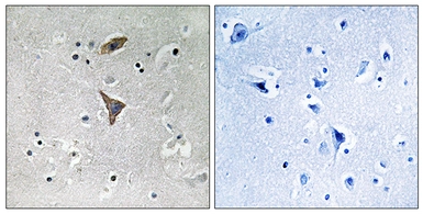 Anti-KCNT1 antibody used in IHC (Paraffin sections) (IHC-P). GTX87812