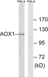 Anti-AOX1 antibody used in Western Blot (WB). GTX87822