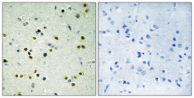 Anti-KDM4B antibody used in IHC (Paraffin sections) (IHC-P). GTX87868