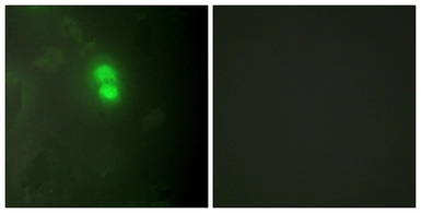 Anti-DKC1 antibody used in Immunocytochemistry/ Immunofluorescence (ICC/IF). GTX87872