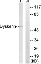 Anti-DKC1 antibody used in Western Blot (WB). GTX87872