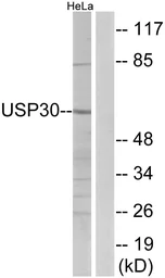 Anti-USP30 antibody used in Western Blot (WB). GTX87959