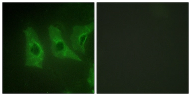 Anti-Casein Kinase 1 alpha antibody used in Immunocytochemistry/ Immunofluorescence (ICC/IF). GTX87999