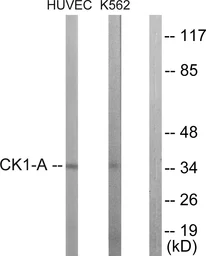 Anti-Casein Kinase 1 alpha antibody used in Western Blot (WB). GTX87999