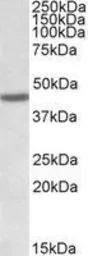 Anti-FANCL antibody, Internal used in Western Blot (WB). GTX88033