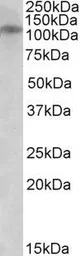 Anti-NMDAR3B antibody, C-term used in Western Blot (WB). GTX88061