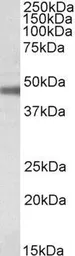 Anti-Sodium/Potassium ATPase beta 1 antibody, Internal used in Western Blot (WB). GTX88074