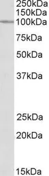 Anti-CLCN2 antibody, Internal used in Western Blot (WB). GTX88176